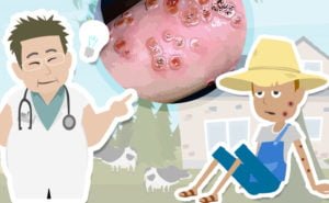 Scopri di più sull'articolo Le origini dei vaccini e il vaccino contro il vaiolo