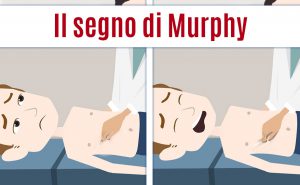 Scopri di più sull'articolo Esame obiettivo: il segno di Murphy per la colecistite acuta