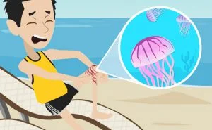 Scopri di più sull'articolo Puntura di medusa: cosa fare?