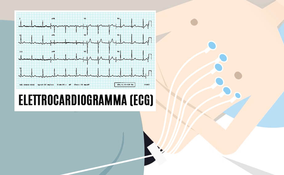 elettrocardiogramma ecg
