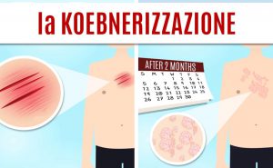 Scopri di più sull'articolo Il fenomeno di Koebner: la psoriasi sulle cicatrici