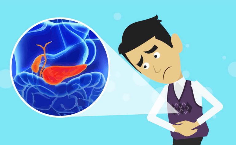 Segni e sintomi di pancreatite acuta