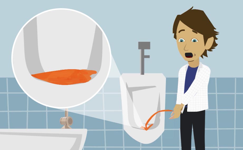 Urine rosse cause rimedi