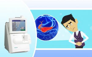 Scopri di più sull'articolo L’emogasanalisi nell’evoluzione della pancreatite acuta