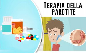 Scopri di più sull'articolo Trattamento della parotite – Come si curano gli orecchioni