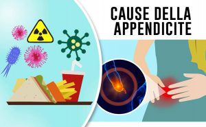 Scopri di più sull'articolo Cause di appendicite acuta