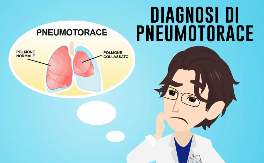 diagnosi sintomi segni esami per lo pneumotorace