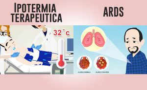 Scopri di più sull'articolo Ipotermia nella ARDS: nuova prospettiva terapeutica?