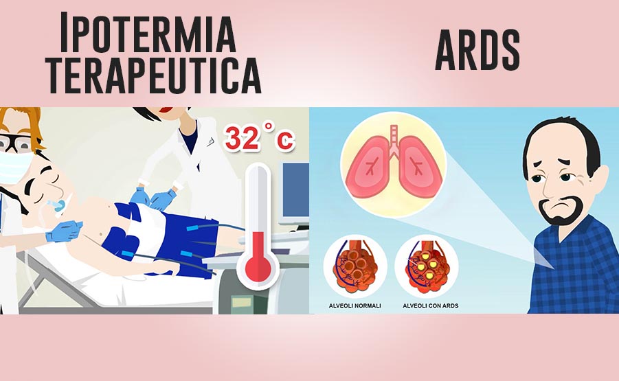 ipotermia in ards prospettiva terapeutica