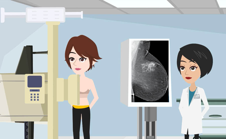 La mammografia è una tecnica diagnostica non invasiva