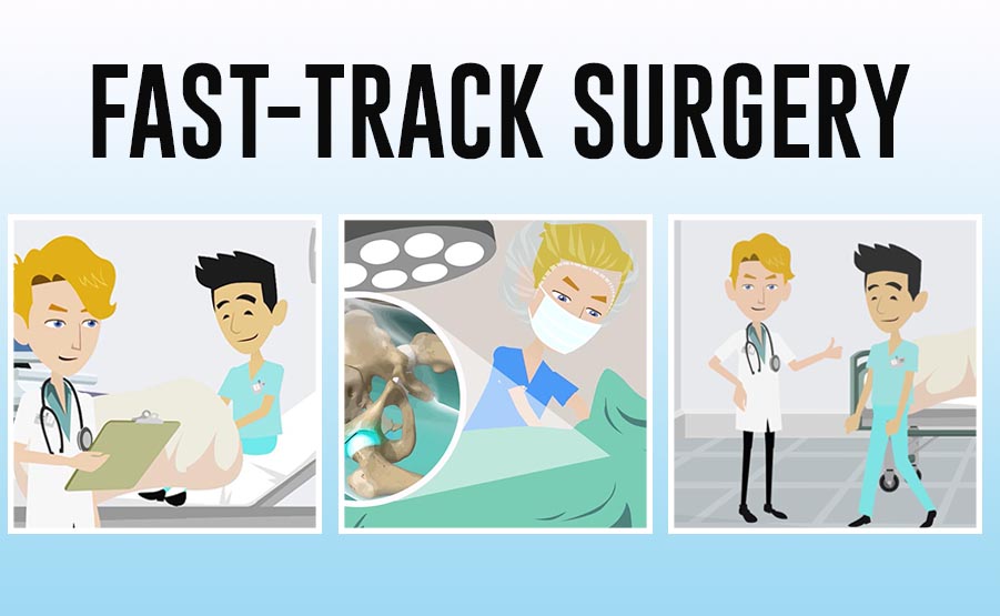 fast-track surgery chirurgia rapida protesi anca ginocchio