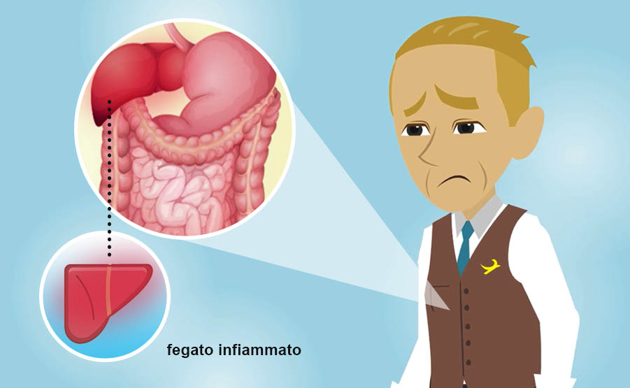 La misurazione delle transaminasi serve a rilevare eventuali patologie del fegato