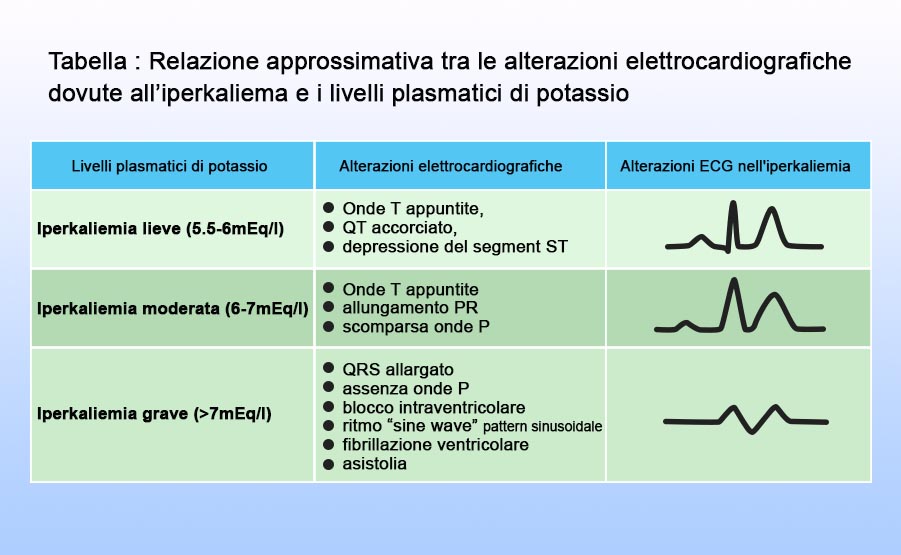 alterazioni elettrocardiografiche in corso di iperkaliemia