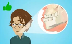 capacità di prognatismo criterio intubazione difficile