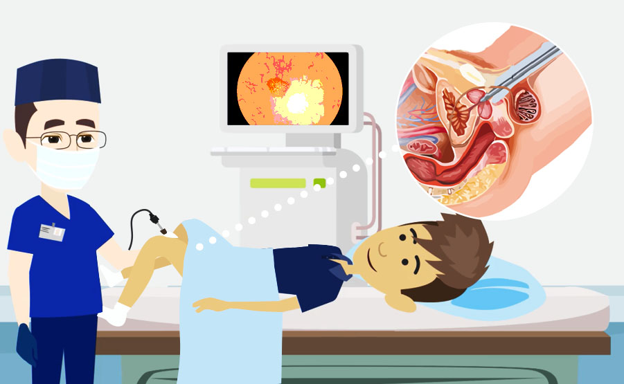 La cistoscopia serve a valutare lo stato di salute di vescica e uretra