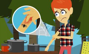 Scopri di più sull'articolo Morso di ragno: cosa fare in caso di puntura di aracnide