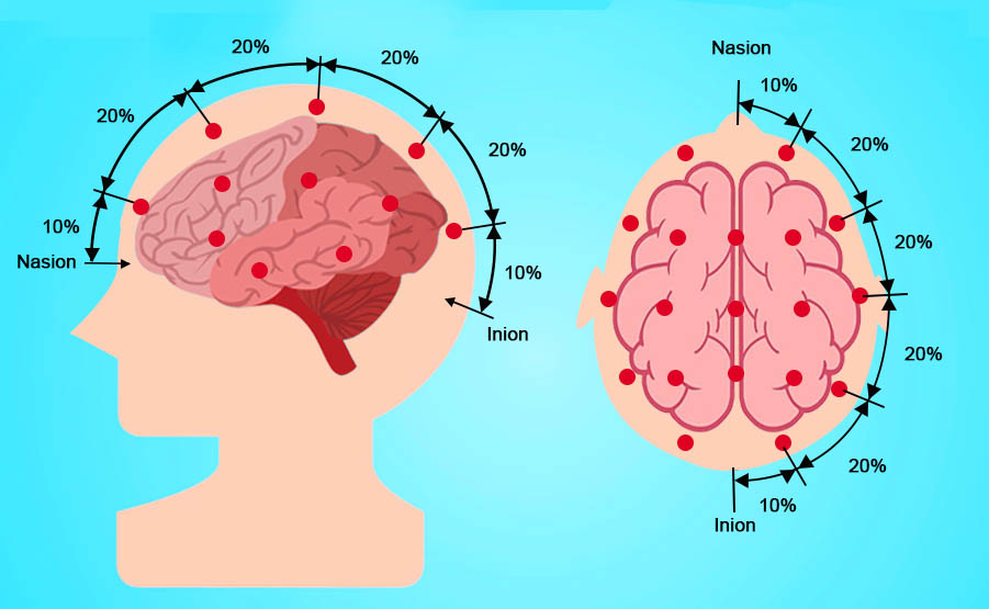 Elettroencefalogramma: posizionamento degli elettrodi