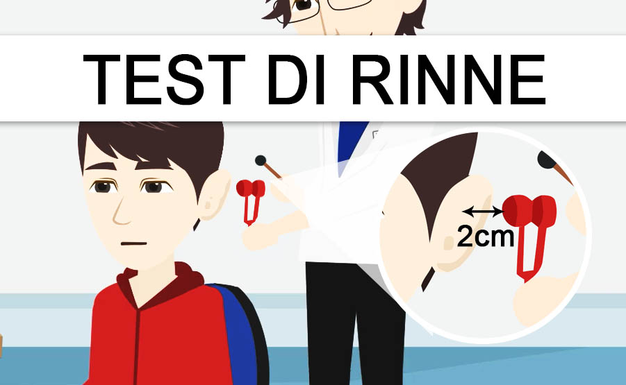 test di rinne ipoacusia