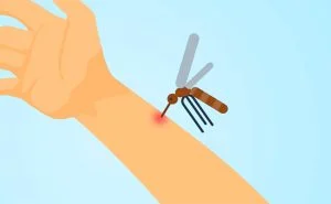 Scopri di più sull'articolo La malaria: cos’è, come si trasmette, come si manifesta