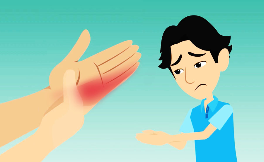 Sindrome del canale di Guyon: dolore e perdita di sensibilità alla mano