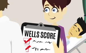 Scopri di più sull'articolo La probabilità di trombosi venosa profonda: il punteggio di Wells