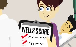 Scopri di più sull'articolo La probabilità di trombosi venosa profonda: il punteggio di Wells