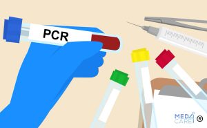 Scopri di più sull'articolo PCR – Proteina C reattiva: cos’è e a cosa serve
