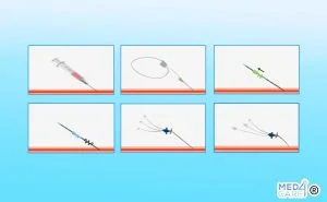 Scopri di più sull'articolo Tecnica di Seldinger: l’uso del filo-guida per le procedure