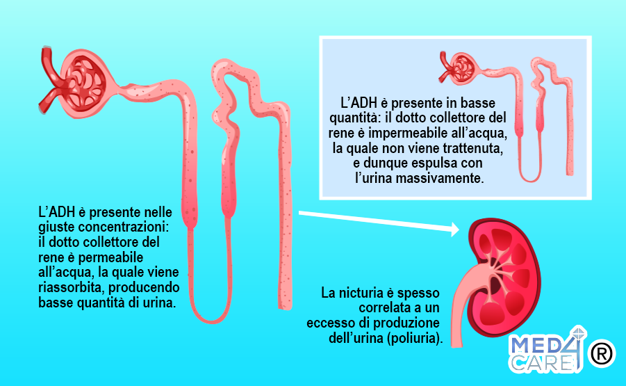 Nicturia: ruolo dell'ormone ADH