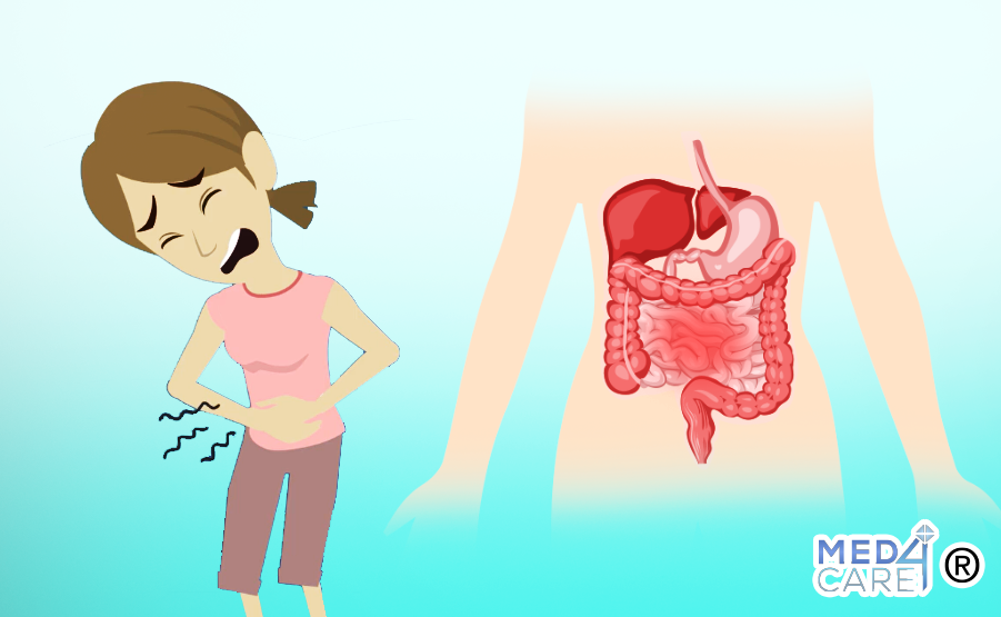 Gastroenterite, gastroenterologia, stomaco, intestino