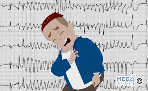 Scopri di più sull'articolo Aritmie cardiache