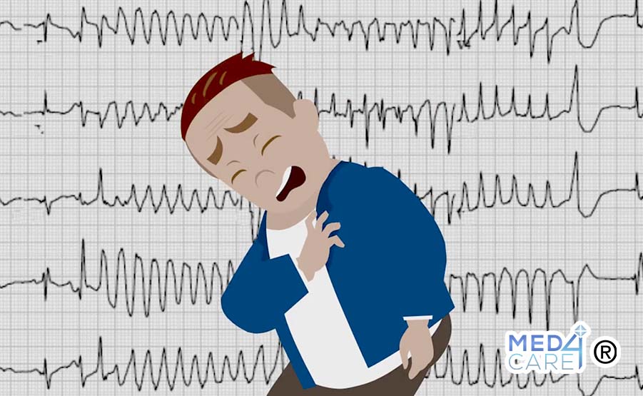 Aritmie cardiache