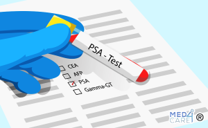 Scopri di più sull'articolo Antigene Prostatico Specifico (PSA): cos’è e a cosa serve