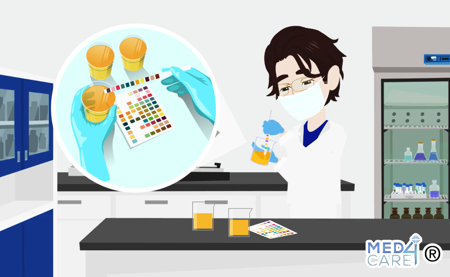 Proteinuria proteine nelle urine