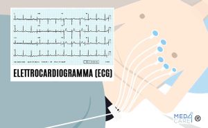 Elettrocardiogramma, ECG