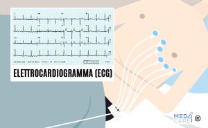 Elettrocardiogramma, ECG