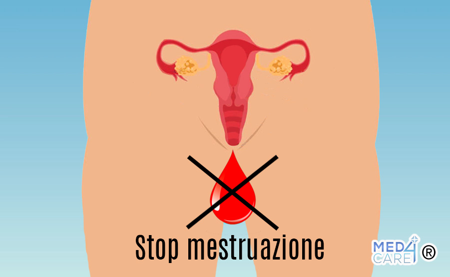 Amenorrea, assenza di mestruazioni