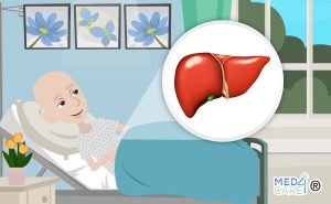 Scopri di più sull'articolo Aumento transitorio delle amminotrasferasi (AST) nei pazienti oncologici: qual è il significato?