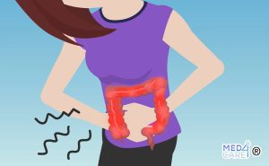 Scopri di più sull'articolo Sindrome dell’intestino irritabile: cause e trattamenti