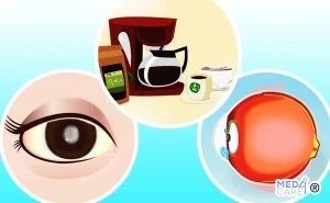 Scopri di più sull'articolo Il consumo abituale di caffè può aumentare il rischio di sviluppare il glaucoma?
