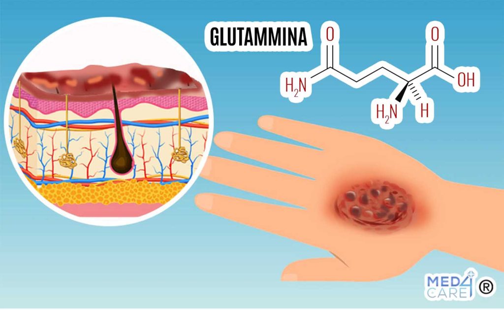 Glutammina e ustioni