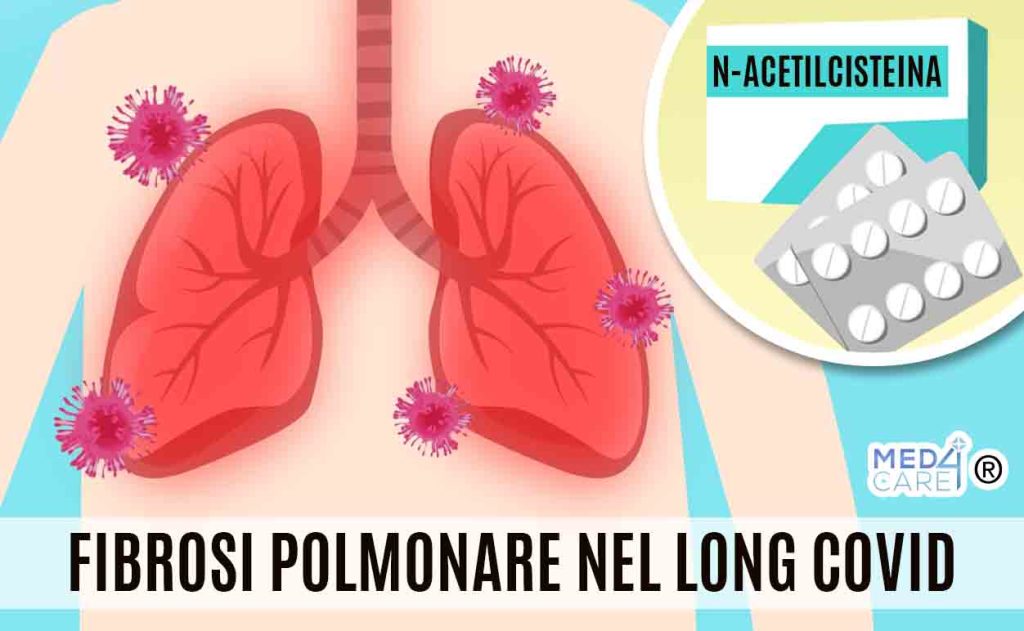 N-acetilcisteina e fibrosi polmonare Long Covid