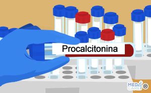 Scopri di più sull'articolo Procalcitonina