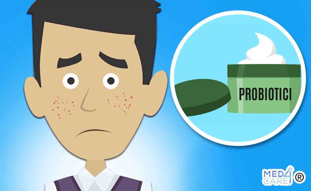Acne vulgaris e probiotici