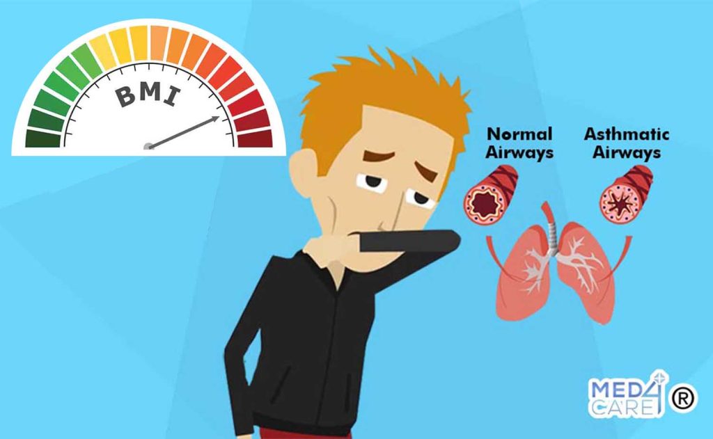Indice di massa corporea e asma