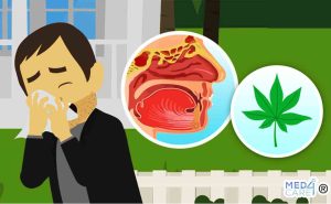 Scopri di più sull'articolo Sintomi infiammatori sino-nasali e uso della cannabis