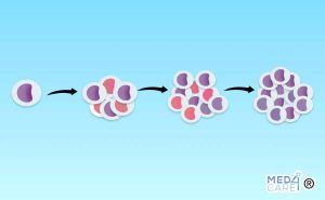 Leucemia mieloide cronica, globuli rossi, globuli bianchi, blasti