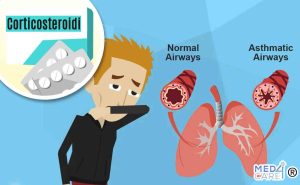Scopri di più sull'articolo Corticosteroidi orali per l’asma: qual è il rischio di morbilità e mortalità?