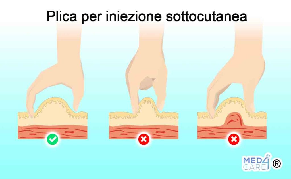 Plica iniezione sottocutanea