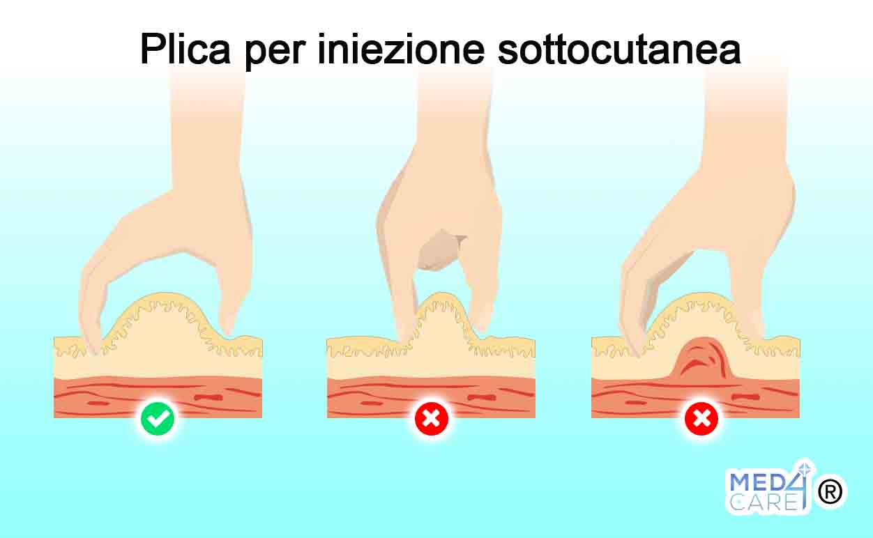 Iniezione sottocutanea come si fa e quando è indicata Med4Care Iniezione sottocutanea come si fa e quando è indicata Med4Care